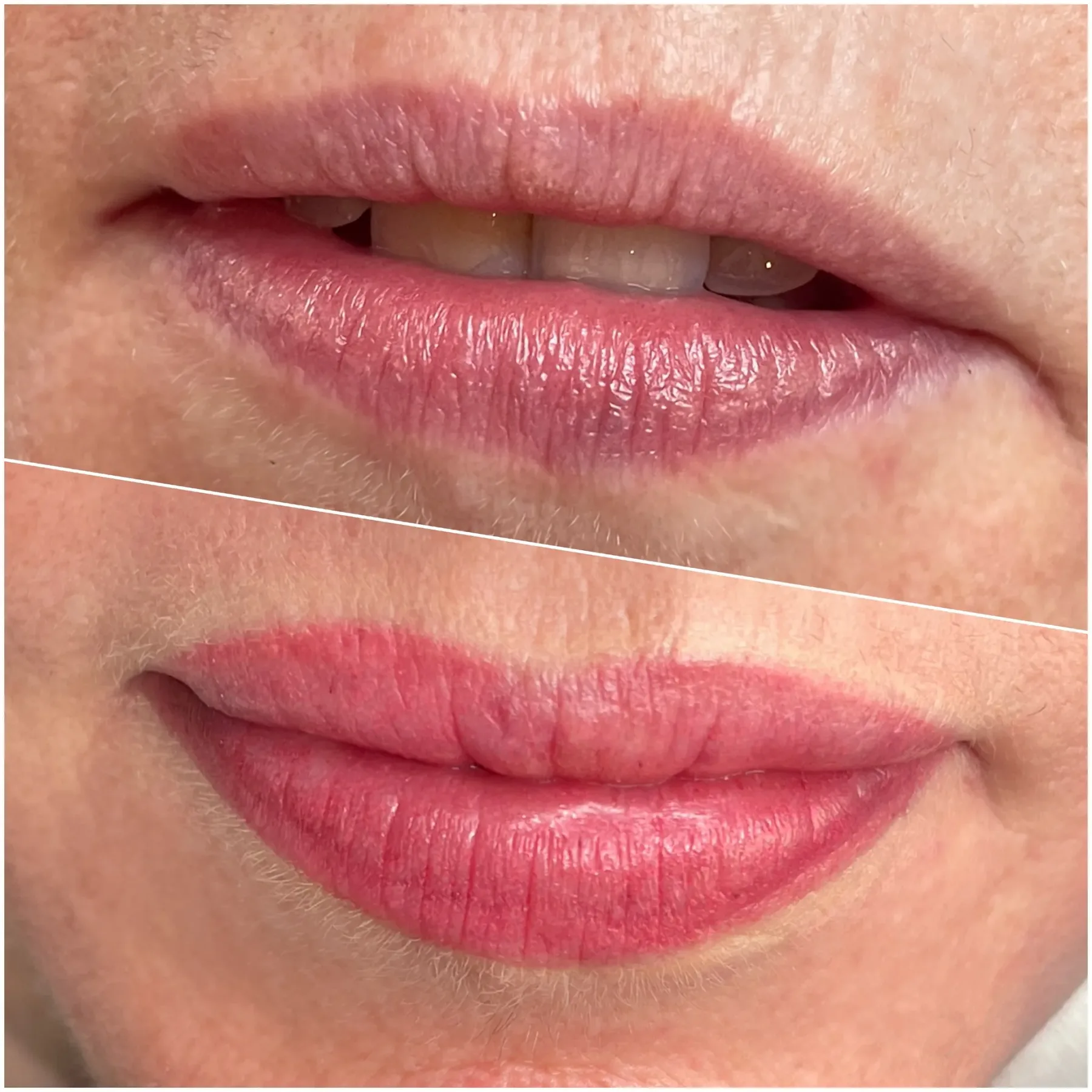 Resultado de micropigmentación de labios